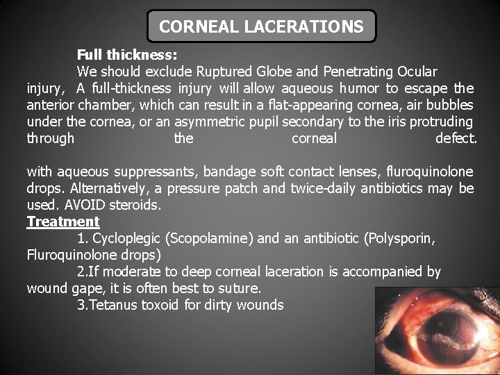 CORNEAL LACERATIONS Full thickness: We should exclude Ruptured Globe and Penetrating Ocular injury, A