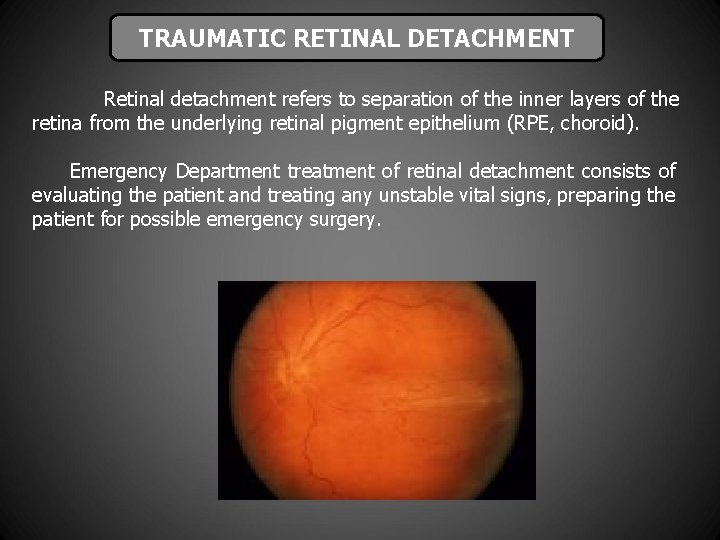 TRAUMATIC RETINAL DETACHMENT Retinal detachment refers to separation of the inner layers of the