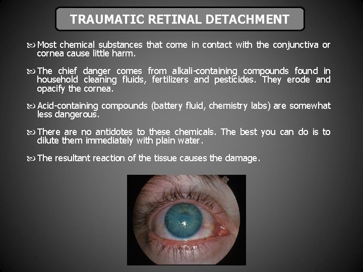 TRAUMATIC RETINAL DETACHMENT Most chemical substances that come in contact with the conjunctiva or