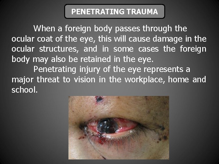 PENETRATING TRAUMA When a foreign body passes through the ocular coat of the eye,