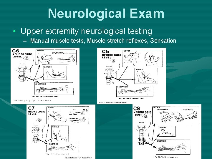 Neurological Exam • Upper extremity neurological testing – Manual muscle tests, Muscle stretch reflexes,