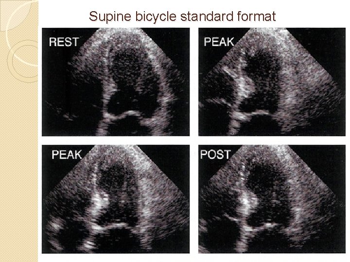 Supine bicycle standard format 