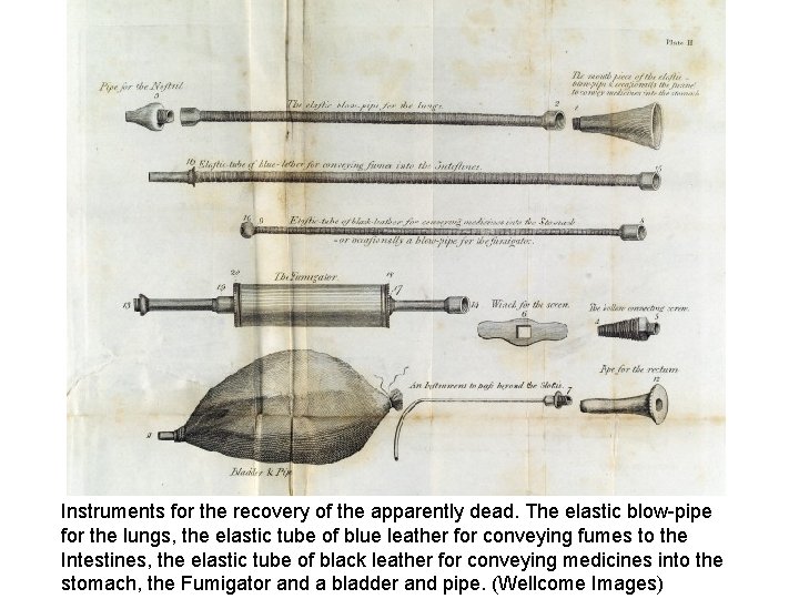 Instruments for the recovery of the apparently dead. The elastic blow-pipe for the lungs,