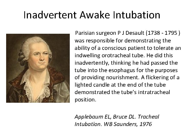 Inadvertent Awake Intubation Parisian surgeon P J Desault (1738 - 1795 ) was responsible