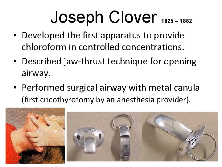 Joseph Clover 1825 – 1882 • Developed the first apparatus to provide chloroform in