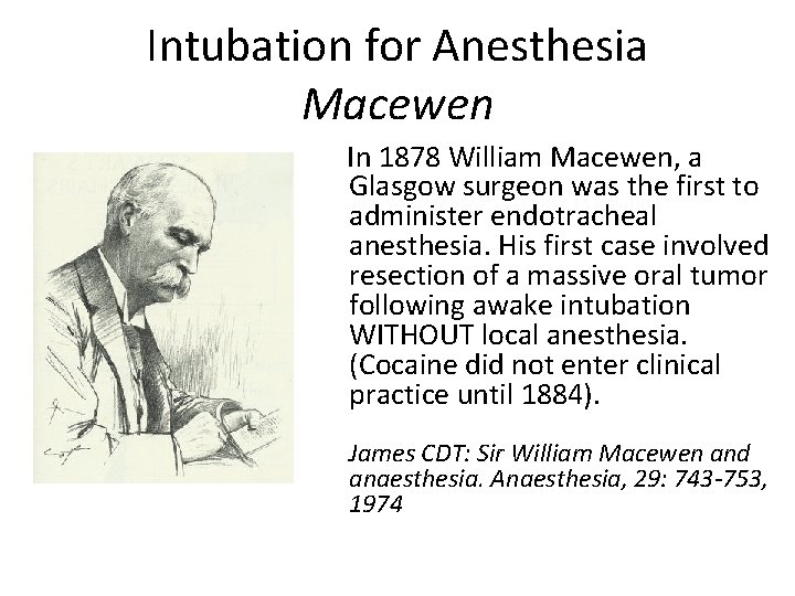 Intubation for Anesthesia Macewen In 1878 William Macewen, a Glasgow surgeon was the first