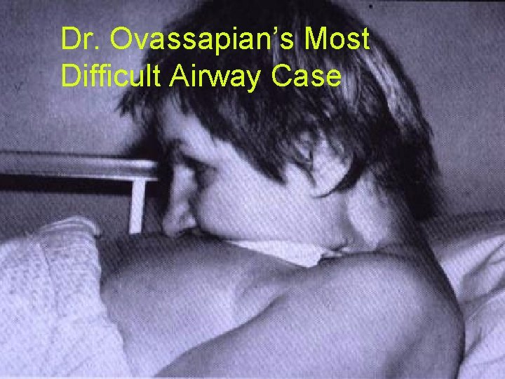 Dr. Ovassapian’s Most Difficult Airway Case 