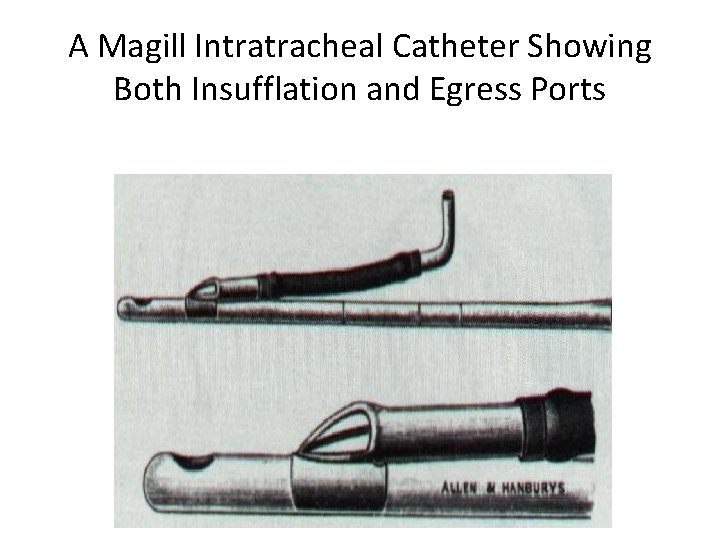 A Magill Intratracheal Catheter Showing Both Insufflation and Egress Ports 