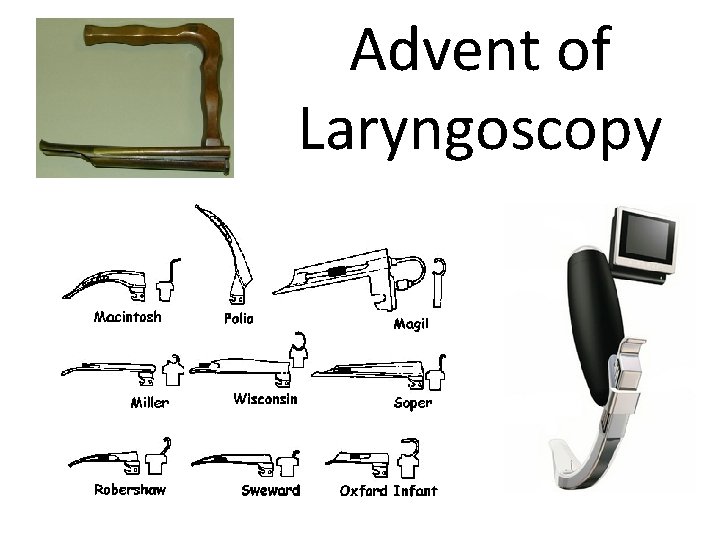 Advent of Laryngoscopy 