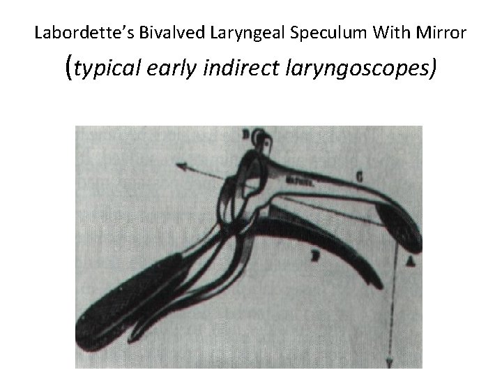 Labordette’s Bivalved Laryngeal Speculum With Mirror (typical early indirect laryngoscopes) 