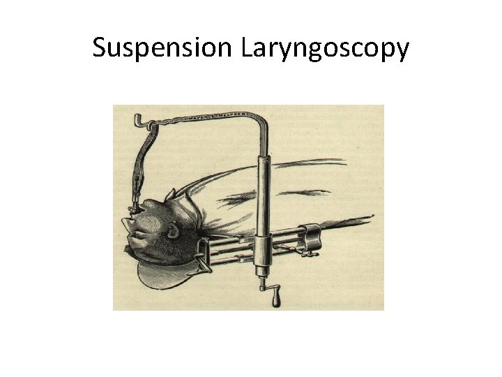 Suspension Laryngoscopy 