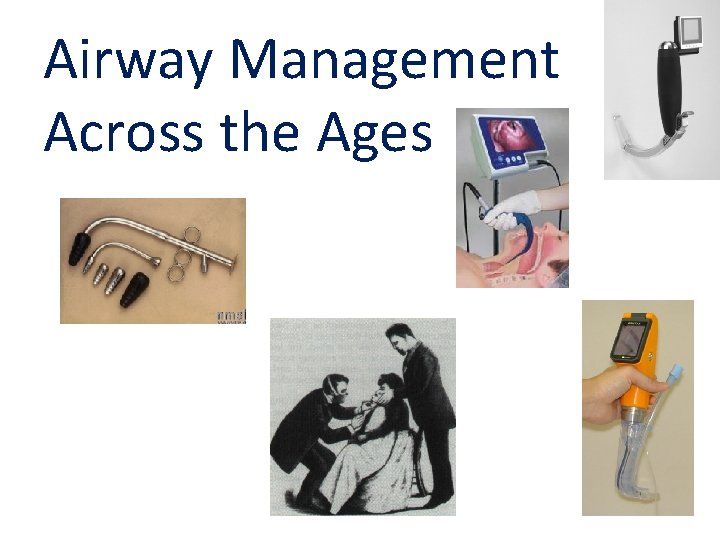 Airway Management Across the Ages 