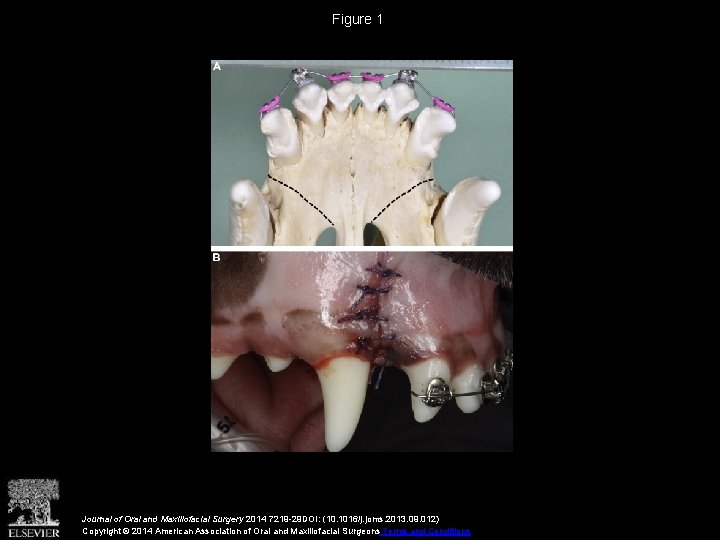 Figure 1 Journal of Oral and Maxillofacial Surgery 2014 7219 -29 DOI: (10. 1016/j.