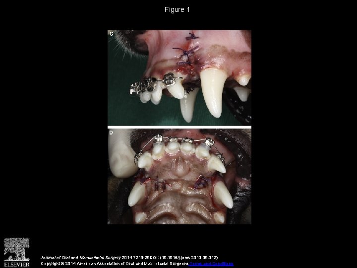 Figure 1 Journal of Oral and Maxillofacial Surgery 2014 7219 -29 DOI: (10. 1016/j.