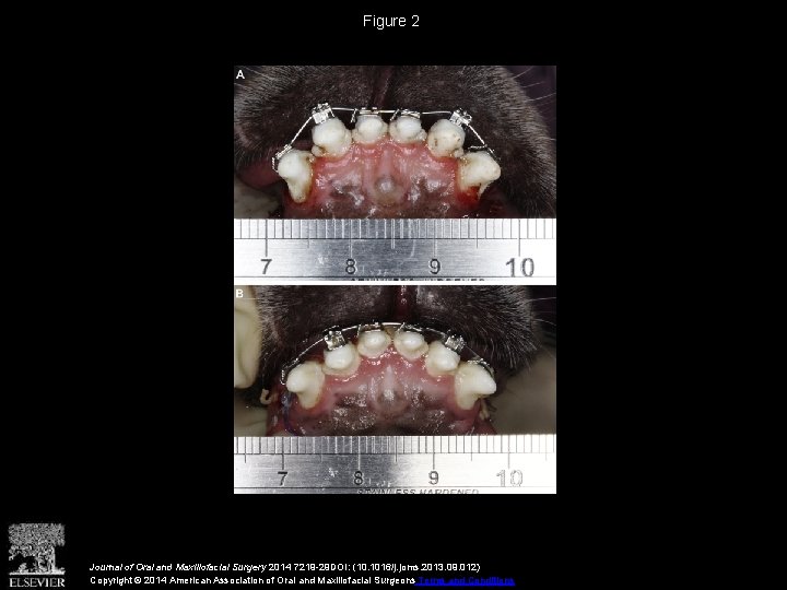 Figure 2 Journal of Oral and Maxillofacial Surgery 2014 7219 -29 DOI: (10. 1016/j.