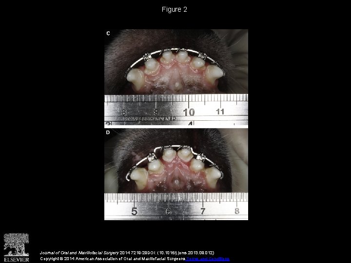 Figure 2 Journal of Oral and Maxillofacial Surgery 2014 7219 -29 DOI: (10. 1016/j.