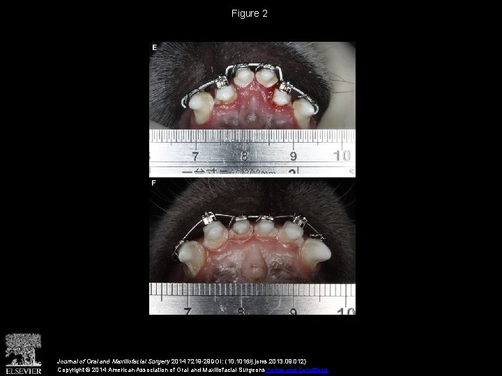 Figure 2 Journal of Oral and Maxillofacial Surgery 2014 7219 -29 DOI: (10. 1016/j.