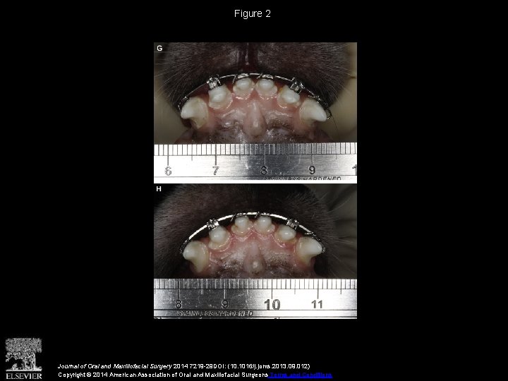 Figure 2 Journal of Oral and Maxillofacial Surgery 2014 7219 -29 DOI: (10. 1016/j.