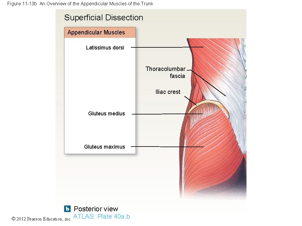 Figure 11 -13 b An Overview of the Appendicular Muscles of the Trunk Superficial