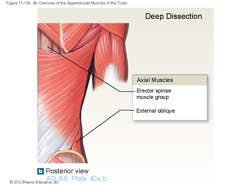 Figure 11 -13 b An Overview of the Appendicular Muscles of the Trunk Deep