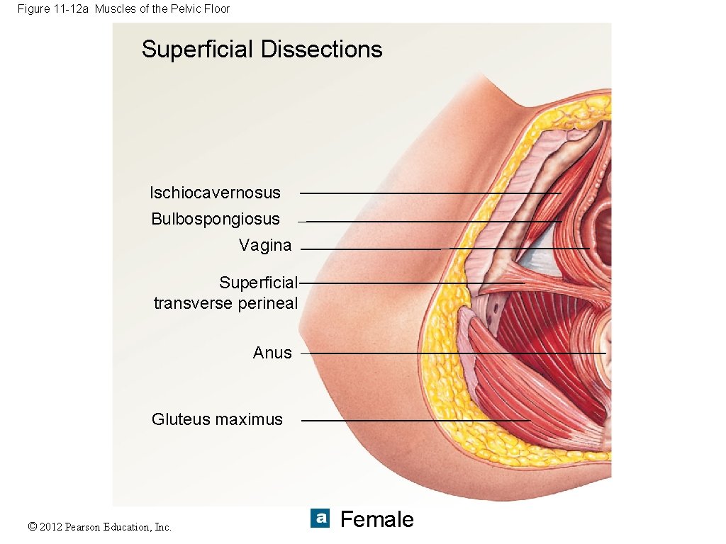 Figure 11 -12 a Muscles of the Pelvic Floor Superficial Dissections Ischiocavernosus Bulbospongiosus Vagina