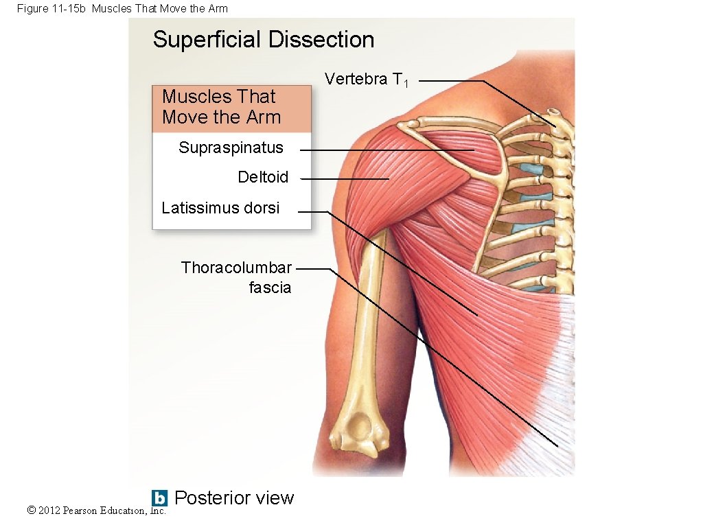 Figure 11 -15 b Muscles That Move the Arm Superficial Dissection Muscles That Move