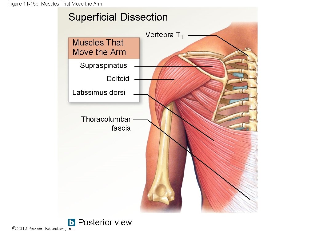 Figure 11 -15 b Muscles That Move the Arm Superficial Dissection Muscles That Move