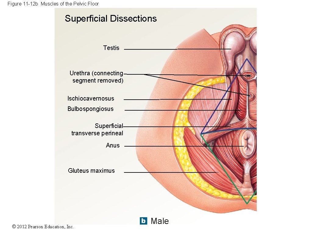 Figure 11 -12 b Muscles of the Pelvic Floor Superficial Dissections Testis Urethra (connecting