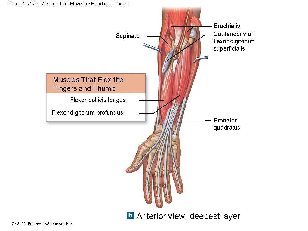 Figure 11 -17 b Muscles That Move the Hand Fingers Supinator Brachialis Cut tendons