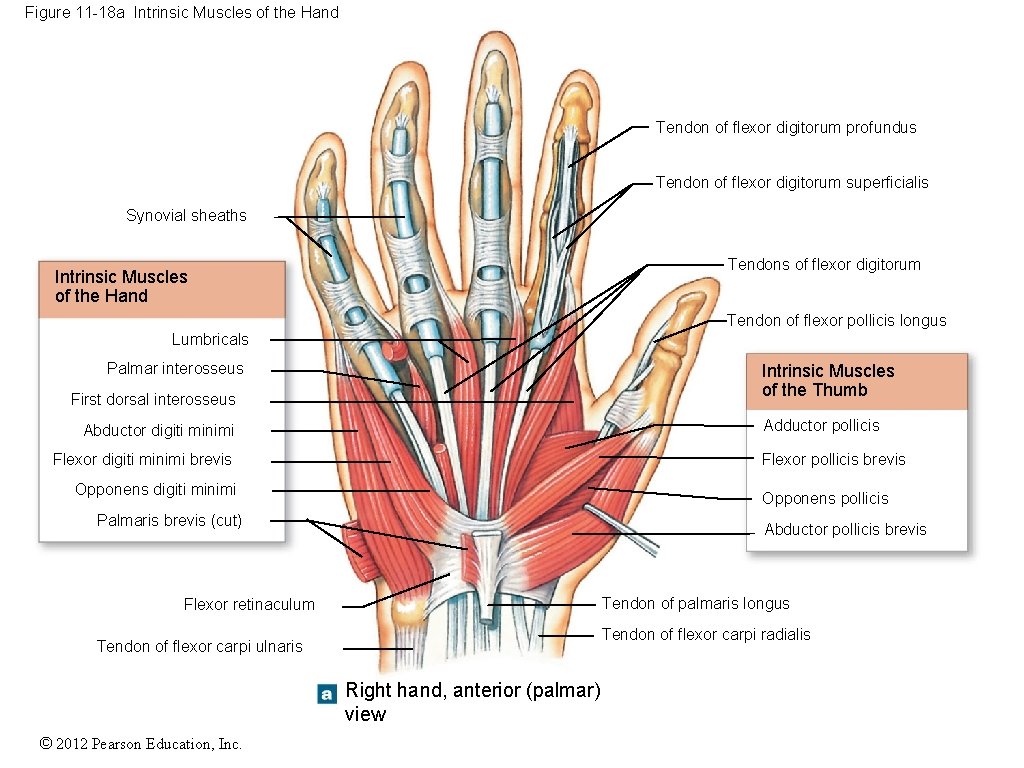 Figure 11 -18 a Intrinsic Muscles of the Hand Tendon of flexor digitorum profundus