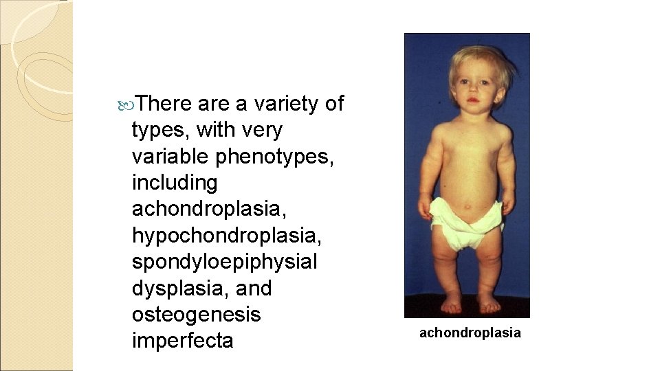  There a variety of types, with very variable phenotypes, including achondroplasia, hypochondroplasia, spondyloepiphysial