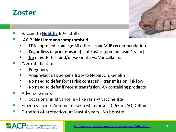 Zoster § § § Vaccinate Healthy 60+ adults [ACIP: Not immunocompromised] • • •