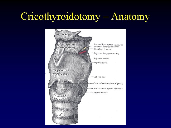 Cricothyroidotomy – Anatomy 