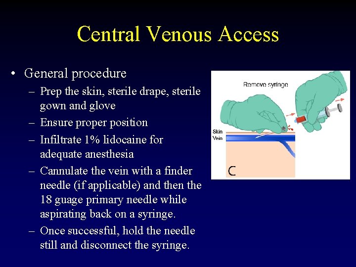 Central Venous Access • General procedure – Prep the skin, sterile drape, sterile gown