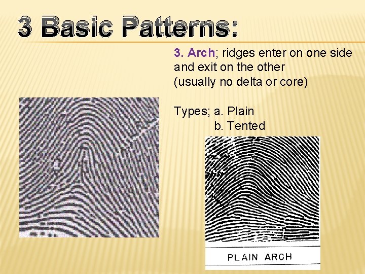 3 Basic Patterns: 3. Arch; ridges enter on one side and exit on the