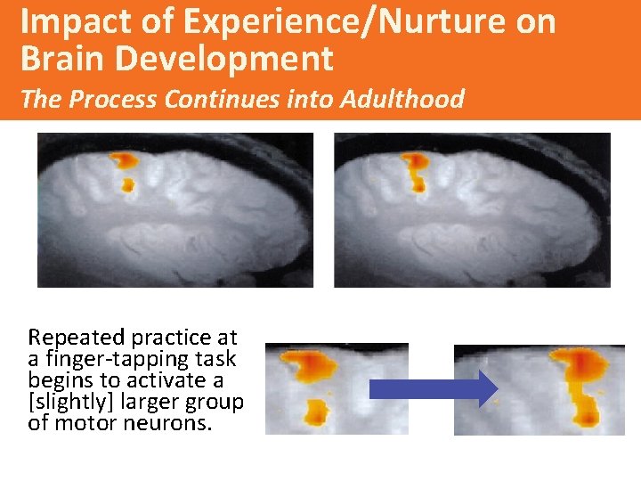 Impact of Experience/Nurture on Brain Development The Process Continues into Adulthood Repeated practice at