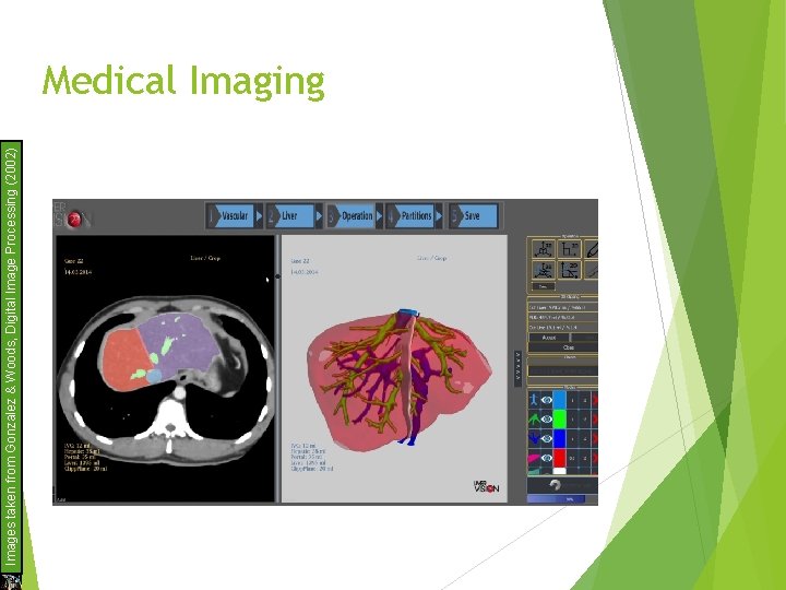 Images taken from Gonzalez & Woods, Digital Image Processing (2002) Medical Imaging 