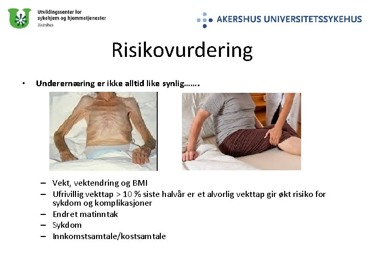 Risikovurdering • Underernæring er ikke alltid like synlig……. – Vekt, vektendring og BMI –