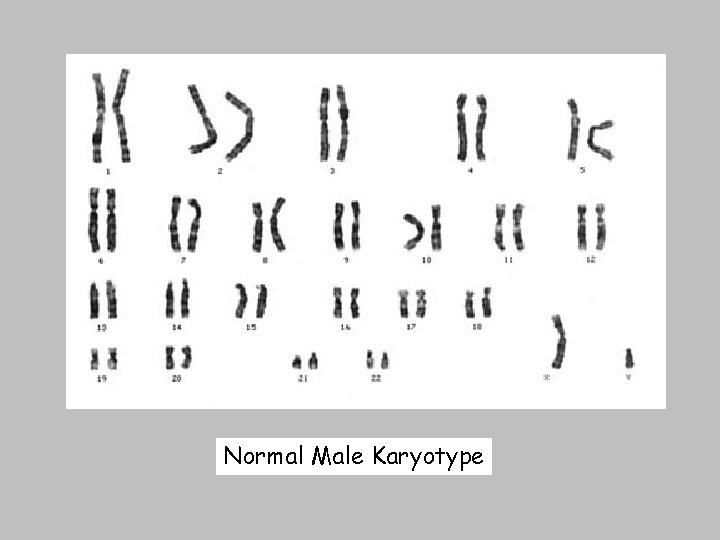 Normal Male Karyotype 