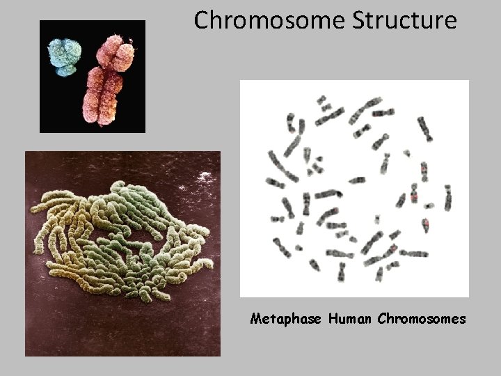 Chromosome Structure Metaphase Human Chromosomes 