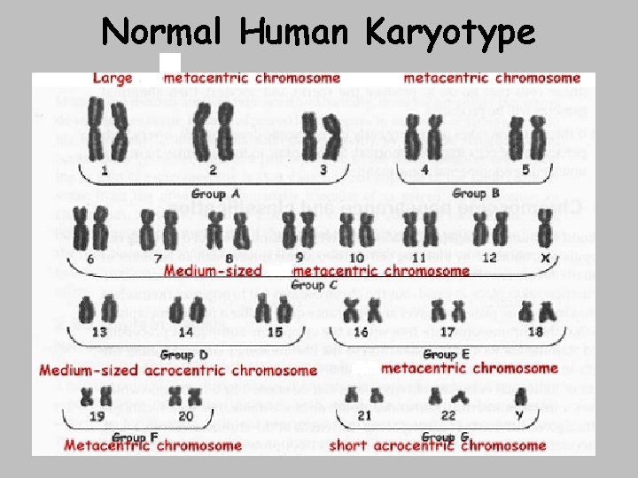 Normal Human Karyotype 