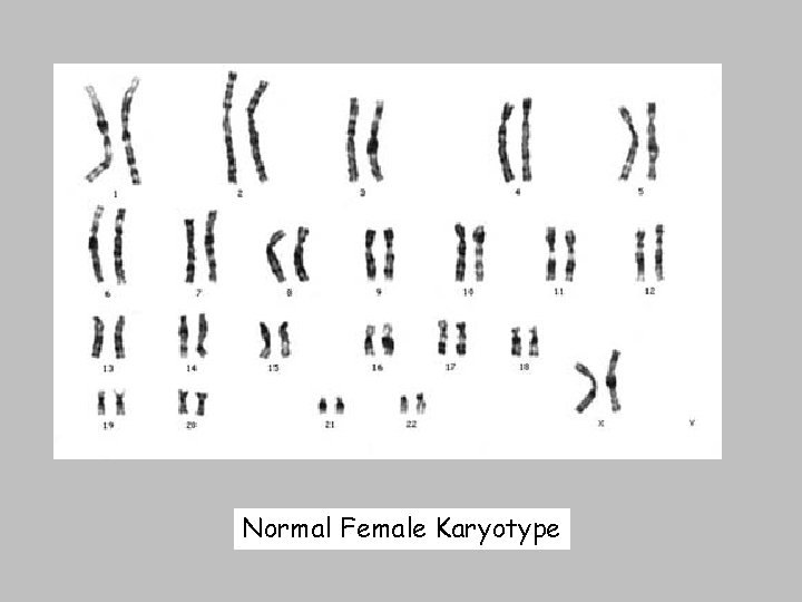 Normal Female Karyotype 