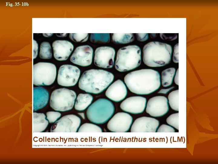 Fig. 35 -10 b 5 µm Collenchyma cells (in Helianthus stem) (LM) 