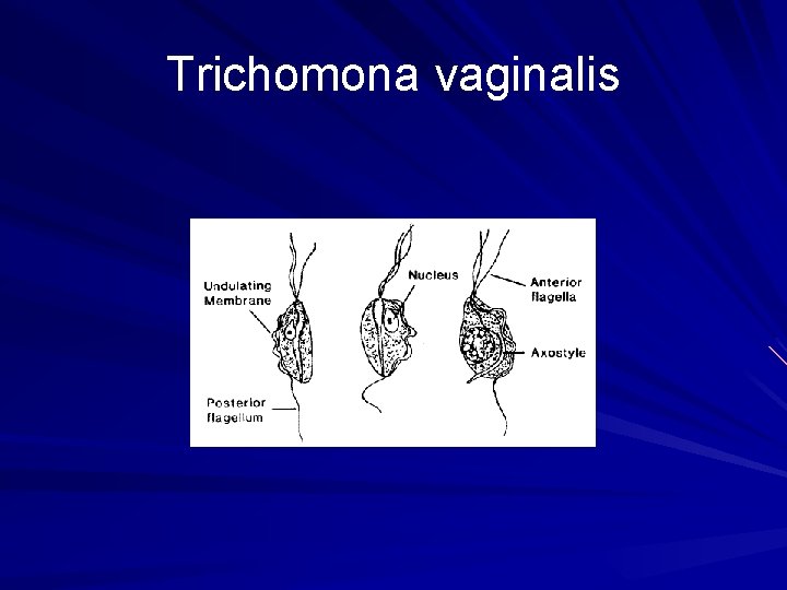Trichomona vaginalis 