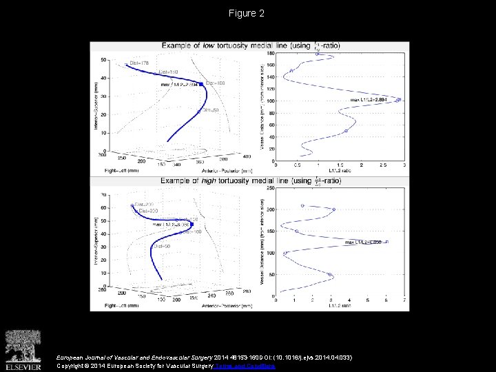 Figure 2 European Journal of Vascular and Endovascular Surgery 2014 48153 -160 DOI: (10.