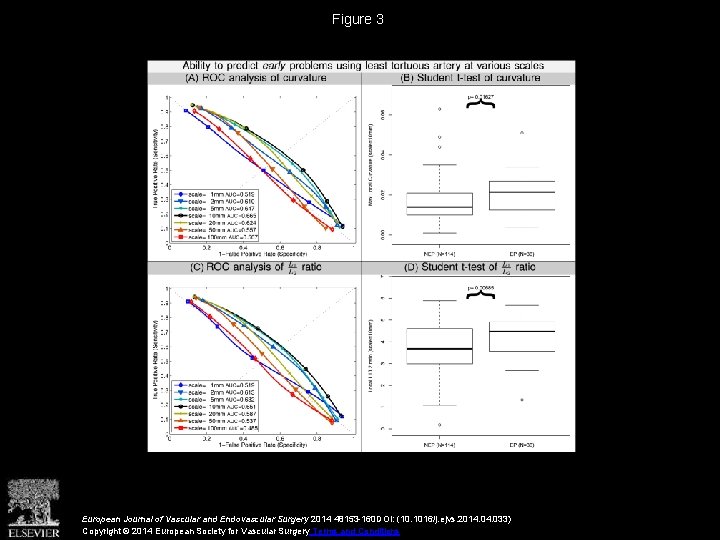 Figure 3 European Journal of Vascular and Endovascular Surgery 2014 48153 -160 DOI: (10.