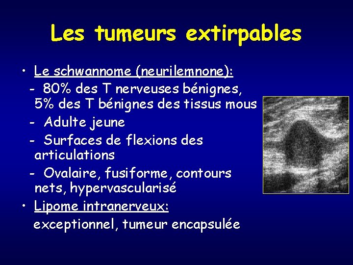 Les tumeurs extirpables • Le schwannome (neurilemnone): - 80% des T nerveuses bénignes, 5%