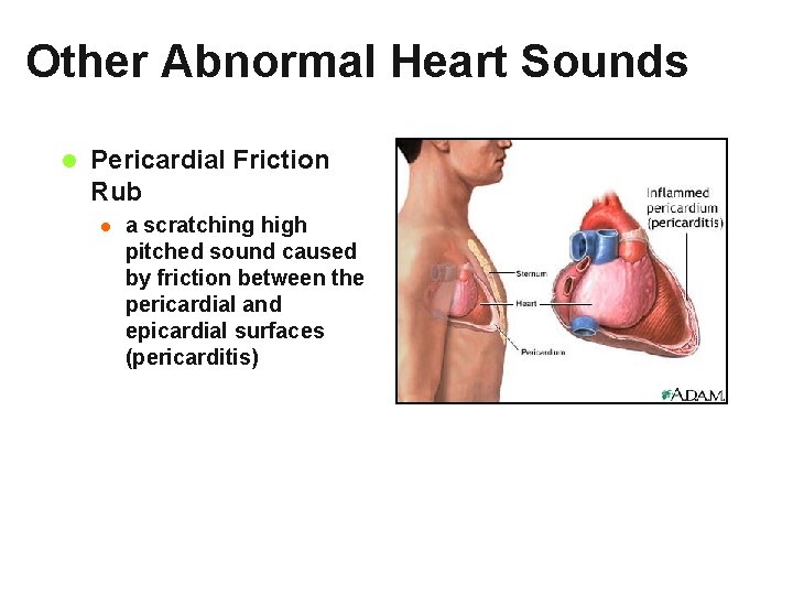 Other Abnormal Heart Sounds l Pericardial Friction Rub l a scratching high pitched sound