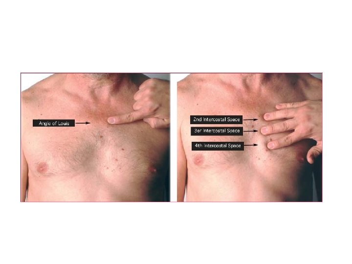 Chest Landmarks 