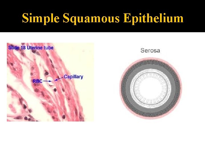 Simple Squamous Epithelium 